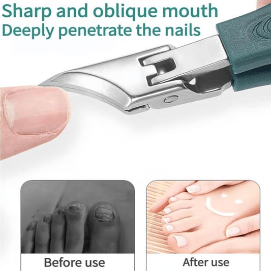 ✂️ 50% DE DESCONTO – Conjunto de 3 Corta-unhas Ângulo Bico de Águia | Corte preciso, lâmina afiada & durável