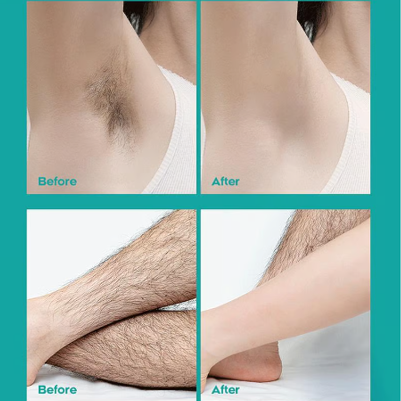 🧴 50% DE DESCONTO – Creme Depilatório para Homens e Mulheres | Sem dor, suave para a pele & ideal para todo o corpo