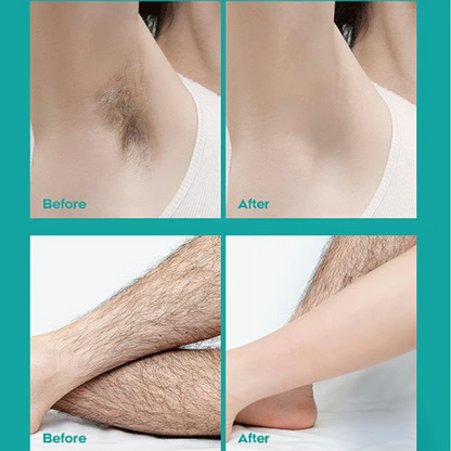 🧴 50% DE DESCONTO – Creme Depilatório para Homens e Mulheres | Sem dor, suave para a pele & ideal para todo o corpo