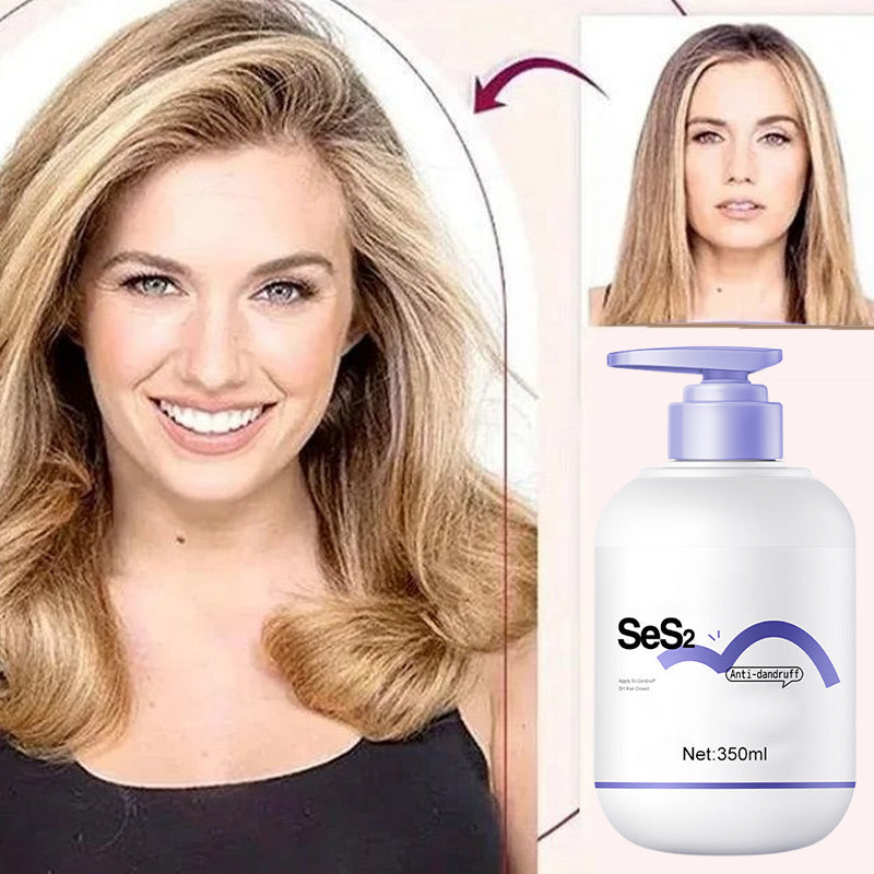 💧 50% ALENNUS🔥 – Syväkosteuttava hilseenestoshampoo | Raikas & hellävarainen – Sopii jokapäiväiseen käyttöön