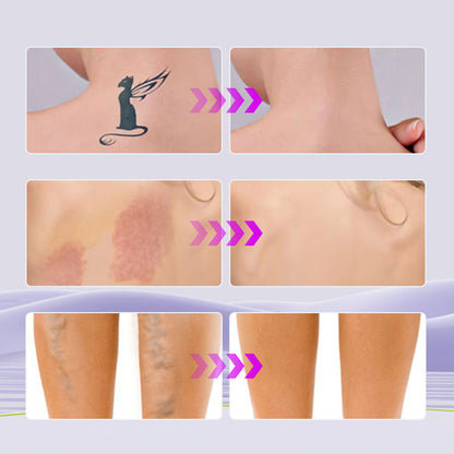 🔥 Promoção 🔥 Corretivo à prova d'água para tatuagens | Cobre instantaneamente & dura o dia todo