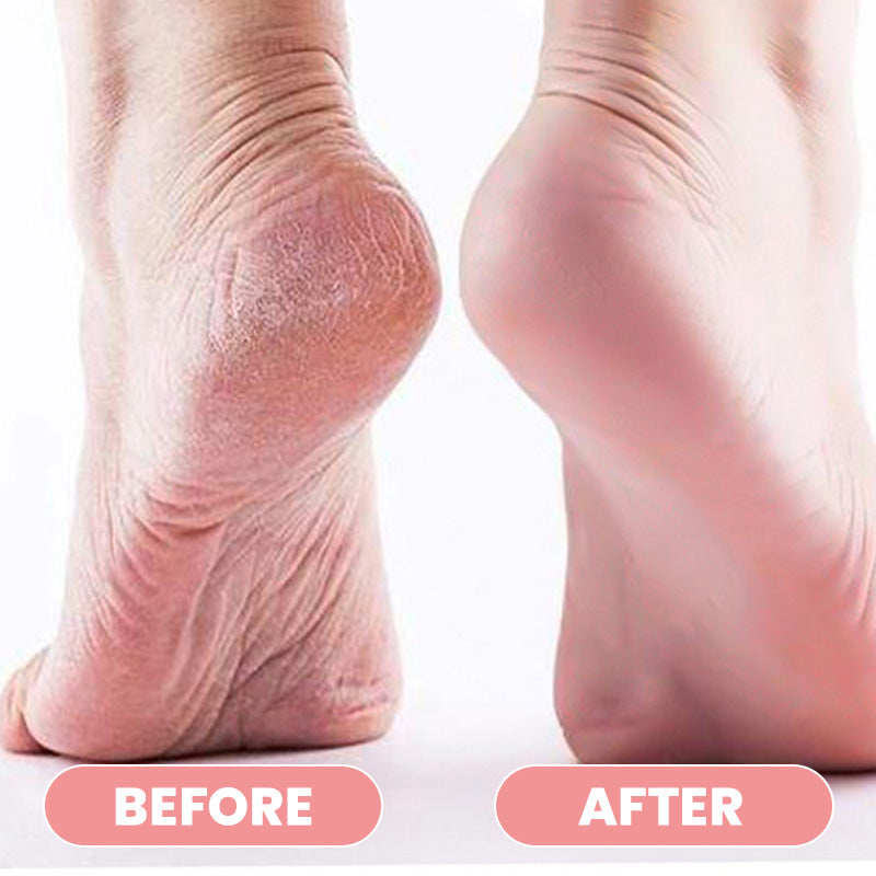 🔥 50% DE DESCONTO – Bastão Hidratante Anti-Rachaduras | Proteção e cuidado intenso para pés e mãos – Repara a pele seca 🦶✨