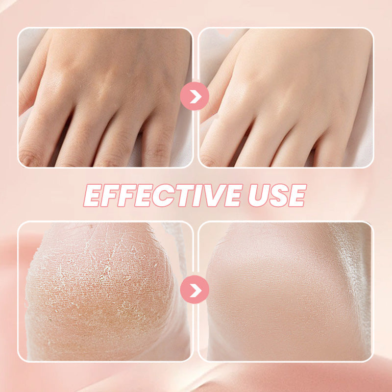 🔥 50% DE DESCONTO – Bastão Hidratante Anti-Rachaduras | Proteção e cuidado intenso para pés e mãos – Repara a pele seca 🦶✨