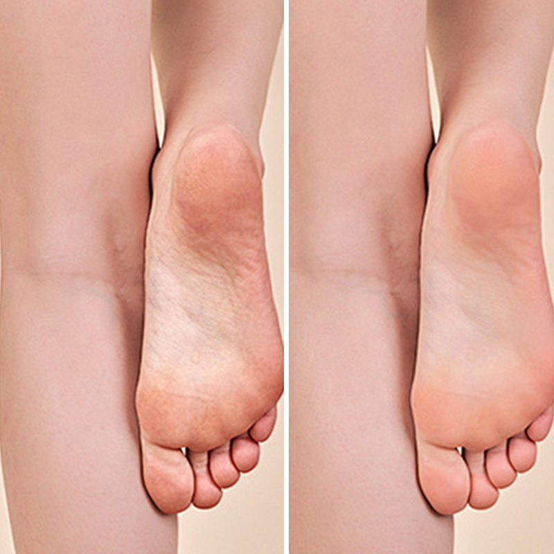 🔥 50% DE DESCONTO – Lixa Elétrica para Pedicure com Visor Digital | Removedor de calos de forma suave, rotação ajustável & fácil de usar