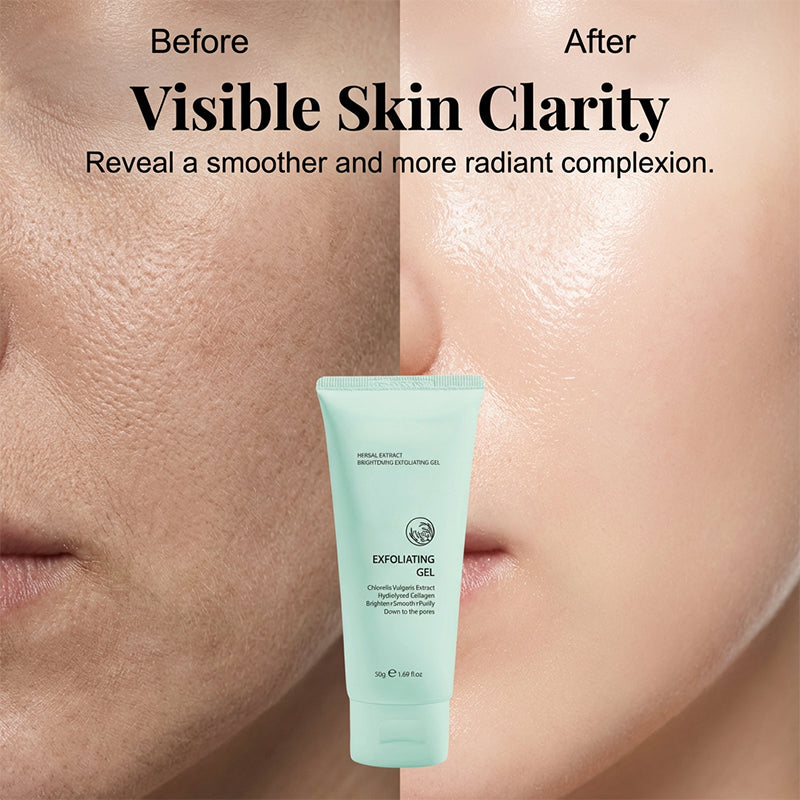 ✨ 50% DE DESCONTO – Gel Esfoliante Clareador com Ervas | Remove células mortas, hidrata & pele radiante