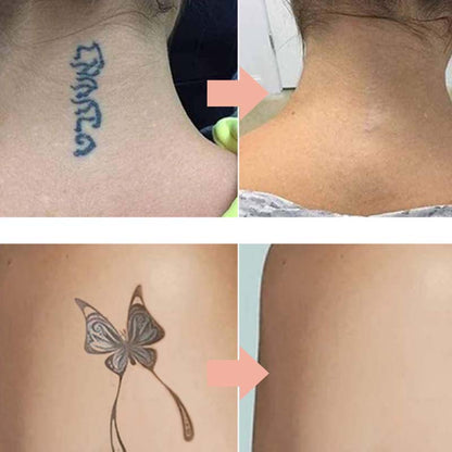 ✨ 50% DE DESCONTO – Creme para Clarear Tatuagens | Suave, eficaz & multiuso