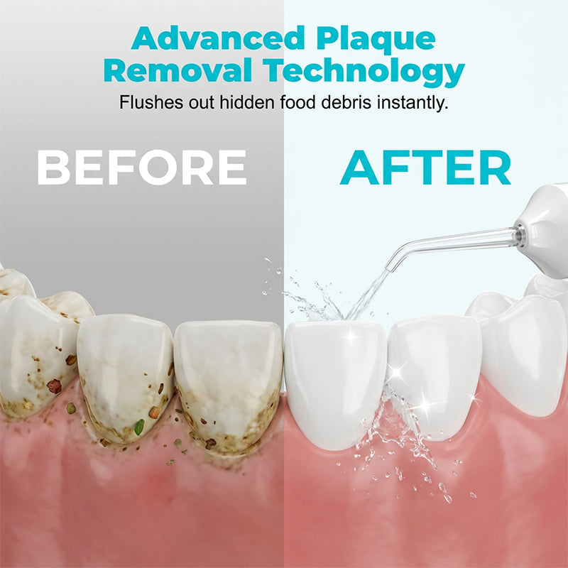 🦷 50% DE DESCONTO – Irrigador Dental Portátil Sem Fios | Limpeza profunda, fácil de usar & ideal para viagens