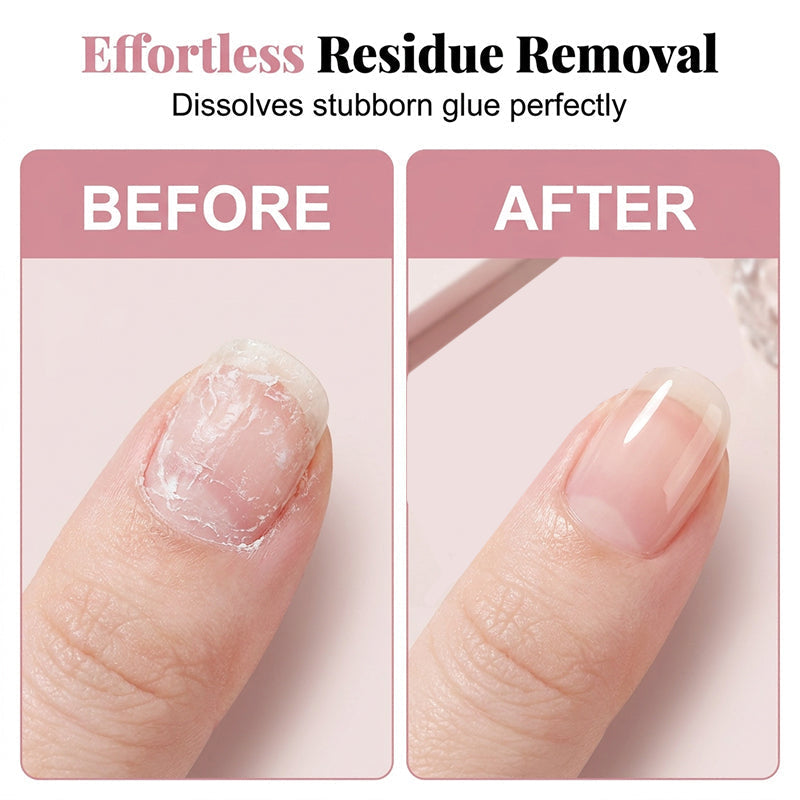 💅 50% DE DESCONTO – Spray Removedor de Adesivo para Unhas Postiças | Remove resíduos sem danificar, fácil aplicação & prática