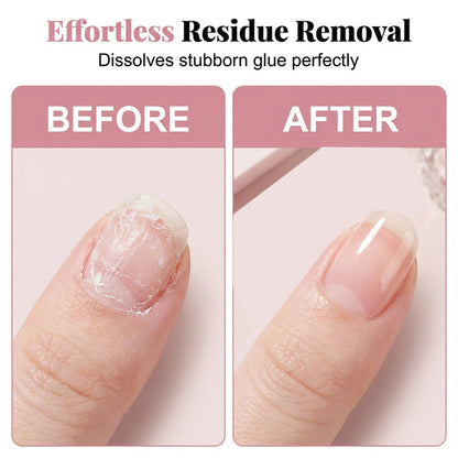 💅 50% DE DESCONTO – Spray Removedor de Adesivo para Unhas Postiças | Remove resíduos sem danificar, fácil aplicação & prática